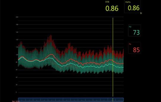 Coronary Physiology Fundamentals (0.50 CE credits) course image