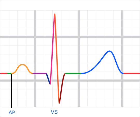 Pacing Basics (4 CE credits) course image