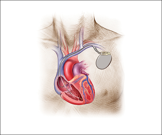 Tachy Follow-up (2 CE credits) course image