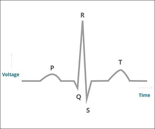 EP Basics – Part 2: ECG Principles & Arrhythmias (1.5 CE credits) course image